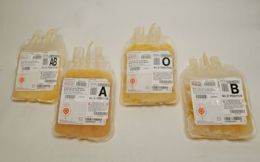 پلاسمای منجمد تازه (FFP–Fresh Frozen Plasma)